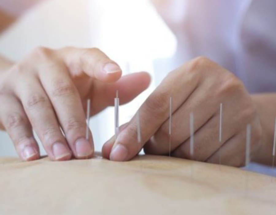 CRBM2 celebra regulamentação do exercício profissional da Acupuntura no Brasil